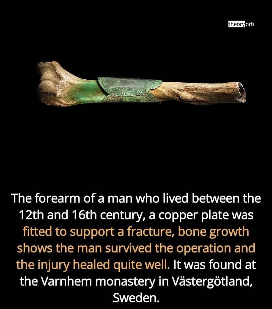 broken bone.jpg